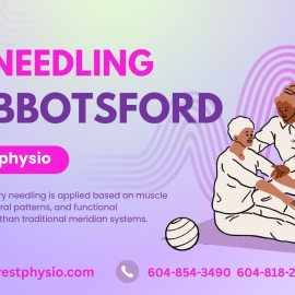 Dry Needling In Abbotsford - Hillcrestphysio